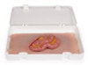 Skin Moulage, Protrusion of Small Intestines