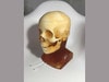 Adult Head (Hematoma) for X-Ray CT, US, MRI