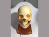 Adult Head (Hematoma) for X-Ray CT, US, MRI