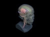 Adult Head (Hematoma) for X-Ray CT, US, MRI