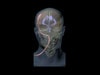 Adult Head (Hematoma) for X-Ray CT, US, MRI