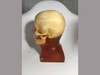 Adult Head (Hematoma) for X-Ray CT, US, MRI