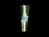 Adult Knee for X-Ray CT, US, MRI