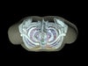 Adult Thorax for X-Ray CT, US, MRI