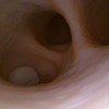 Bronchi Skill Module for Airway Management Task Trainer V2