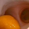 Bronchi Skill Module for Airway Management Task Trainer V2