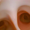 Bronchi Skill Module for Airway Management Task Trainer V2