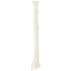 Axis Scientific Radius Bone