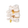 Lumbar Vertebrae Anatomy Model - Right Side View