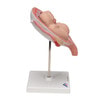 5th Month Human Twin Fetus Model