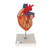 Human Heart Anatomy Model With Bypass