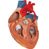 Human Heart Anatomy Model With Bypass