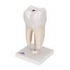 Lower Twin-Root Molar Anatomy Model 2 Parts