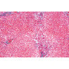 Human Pathology - English Microscope Slides Basic Set