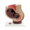 Pregnancy Pelvis Model with 40-Week Fetus, 3-Parts, Dark Skin