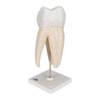 Upper Triple-Root Molar Tooth Anatomy Model