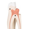 Upper Triple-Root Molar Tooth Anatomy Model