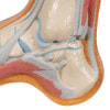 Hollow Foot Pes Cavus Anatomy Model