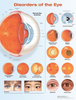 Disorders Of The Eye Laminated Anatomical Chart - 3rd Edition