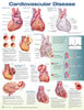 Cardiovascular Disease Laminated Anatomical Chart - 3rd Edition