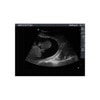 Percutaneous Umbilical Cord Blood Sampling Ultrasound Training Model