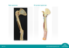 3D Printed Upper Limb - Biceps, Bones and Ligaments