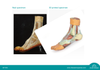 3D printed foot. Full view. Exposed muscles, tendons, ligaments, and bones.