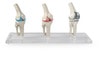 Knee Implant Model