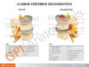 Four Stage Vertebrae Set Anatomy Model