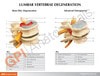 Four Stage Vertebrae Set Anatomy Model