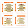 Four Stage Vertebrae Set Anatomy Model