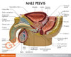 Male Pelvis Anatomy Model With Testicular Cancer