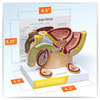 Male Pelvis Anatomy Model With Testicular Cancer