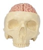 Diseased Brain In Skull Anatomy Model
