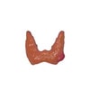 Thyroid Disease Anatomy Model