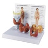 Thyroid Disease Anatomy Model