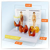 Thyroid Disease Anatomy Model