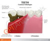 Diseased Teeth and Gums Anatomy Model