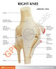 Basic Knee With Key Card Anatomy Model