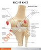 Basic Knee With Key Card Anatomy Model