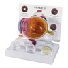 Cataract Eye Anatomy Model