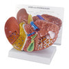 Diseased Liver Anatomy Model