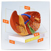 Diseased Liver Anatomy Model