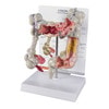 Colon Anatomy Model With Pathologies