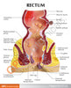 Rectum Anatomy Model With Pathologies