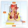 Rectum Anatomy Model With Pathologies
