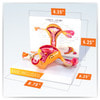 Uterus and Ovary Anatomy Model With Pathologies