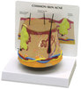Acne Skin Anatomy Model