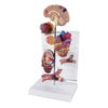 Hypertension Anatomy Model Set