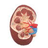 Hypertension Anatomy Model Set
